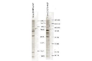 Western blot analysis is shown using anti-SH3BP2 pS427 antibody to detect endogenous protein present in unstimulated human whole cell lysates). (SH3BP2 anticorps  (pSer427))