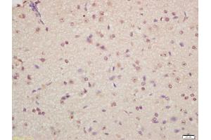Formalin-fixed and paraffin embedded mouse brain labeled with Anti-Musashi 1/Msi1 Polyclonal Antibody, Unconjugated (ABIN1387744) at 1:200 followed by conjugation to the secondary antibody and DAB staining (Musashi 1/2 (AA 66-150) anticorps)