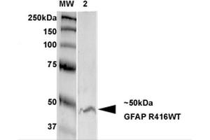 Western Blot analysis of Rat Brain Membrane showing detection of GFAP protein using Mouse Anti-GFAP Monoclonal Antibody, Clone S206B-9 . (GFAP anticorps  (AA 411-422) (HRP))
