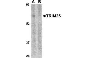 Western blot analysis of TRIM25 in human thymus tissue lysate in (A) the absence and (B) presence of blocking peptide with this product at 1 μg/ml.