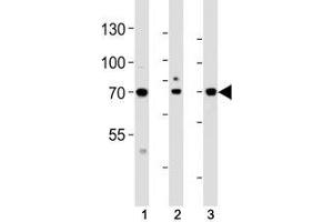 Western blot analysis of lysate from (1) HeLa, (2) HepG2 and (3) human placenta tissue lysate using ATF6 beta antibody at 1:1000.