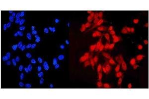 IF analysis of NDC80 using anti-NDC80 antibody (ABIN7602585). (NDC80 anticorps  (AA 87-602))