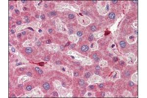 Human Liver (formalin-fixed, paraffin-embedded) stained with RBP1followed by biotinylated anti-goat IgG secondary antibody, alkaline phosphatase-streptavidin and chromogen. (RBP1 anticorps  (C-Term))