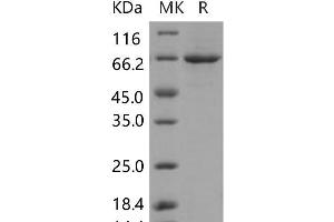 Western Blotting (WB) image for Polo-Like Kinase 1 (PLK1) (Active) protein (His tag) (ABIN7320008)