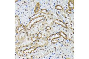 Immunohistochemistry of paraffin-embedded mouse kidney using SMN1 antibody (ABIN7270652) at dilution of 1:100 (40x lens).