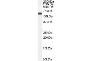 Western Blotting (WB) image for anti-Family with Sequence Similarity 107, Member A (FAM107A) (N-Term) antibody (ABIN2156803) (FAM107A anticorps  (N-Term))