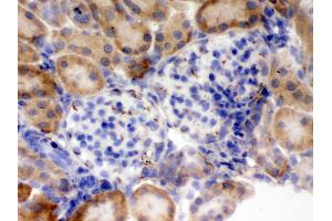 IHC analysis of Flotillin 2 using anti-Flotillin 2 antibody .