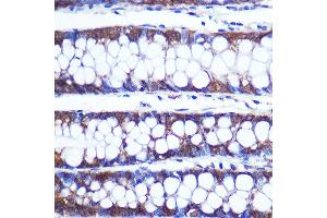 Immunohistochemistry of paraffin-embedded Human colon using TOP1MT Rabbit pAb (ABIN7270851) at dilution of 1:100 (40x lens). (TOP1MT anticorps  (AA 470-550))
