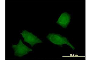 Immunofluorescence of monoclonal antibody to IREB2 on HeLa cell.