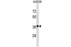 Western Blotting (WB) image for anti-TruB Pseudouridine (Psi) Synthase Homolog 2 (TRUB2) antibody (ABIN3001393) (TRUB2 anticorps)