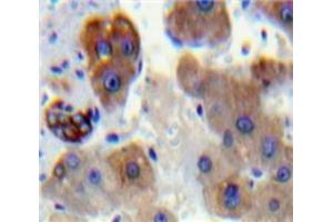 IHC-P analysis of Liver tissue, with DAB staining. (PNPLA2 anticorps  (AA 481-702))