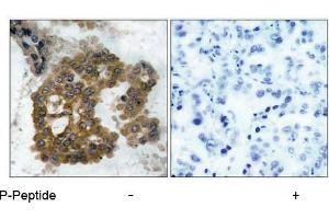 Image no. 1 for anti-V-Akt Murine Thymoma Viral Oncogene Homolog 2 (AKT2) (pSer474) antibody (ABIN196826) (AKT2 anticorps  (pSer474))