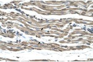 Immunohistochemical staining (Formalin-fixed paraffin-embedded sections) of human muscle with COX15 polyclonal antibody  at 4-8 ug/mL working concentration. (COX15 anticorps  (N-Term))