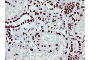 Image no. 8 for anti-Non-POU Domain Containing, Octamer-Binding (NONO) (AA 184-385) antibody (ABIN1491072) (NONO anticorps  (AA 184-385))