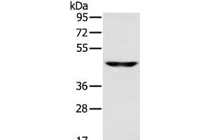 Western Blot analysis of Human fetal brain tissue using SLC16A8 Polyclonal Antibody at dilution of 1:200 (MCT3 anticorps)