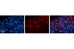 Rabbit Anti-MLX Antibody   Formalin Fixed Paraffin Embedded Tissue: Human Liver Tissue Observed Staining: Nucleus in hepatocytes Primary Antibody Concentration: 1:100 Other Working Concentrations: N/A Secondary Antibody: Donkey anti-Rabbit-Cy3 Secondary Antibody Concentration: 1:200 Magnification: 20X Exposure Time: 0.