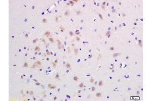 Formalin-fixed and paraffin embedded rat brain labeled with Rabbit Anti JNK1/2/3 Polyclonal Antibody, Unconjugated (ABIN747713) at 1:200 followed by conjugation to the secondary antibody and DAB staining (JNK anticorps  (AA 151-250))