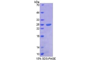 Image no. 1 for Aristaless Related Homeobox (ARX) (AA 25-246) protein (T7 tag,His tag) (ABIN6238744)