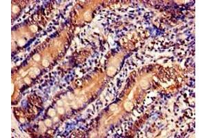 Immunohistochemistry of paraffin-embedded human small intestine tissue using ABIN7175158 at dilution of 1:100 (USP6NL anticorps  (N-Term))