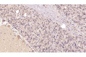 Detection of PTHR2 in Human Cerebellum Tissue using Monoclonal Antibody to Parathyroid Hormone Receptor 2 (PTHR2) (PTH2R anticorps  (AA 27-145))
