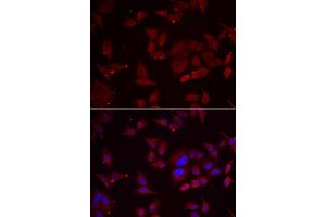 Immunofluorescence analysis of U2OS cell using PFKFB3 antibody. (PFKFB3 anticorps)
