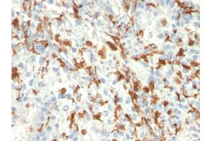 Formalin-fixed, paraffin-embedded human Kidney stained with AIF1 / Iba1 Mouse Monoclonal Antibody (AIF1/2493). (Iba1 anticorps  (AA 1-146))