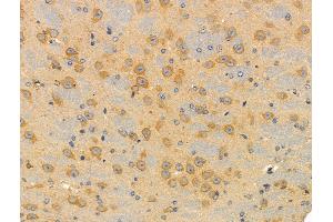 ABIN6259540 and ABIN6274453 at 1/100 staining Mouse brain tissue by IHC-P.