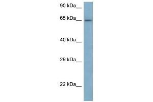 Western Blot showing ARFGAP3 antibody used at a concentration of 1 ug/ml against 721_B Cell Lysate (ARFGAP3 anticorps  (N-Term))