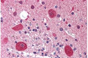 Human Brain, Cerebellum (formalin-fixed, paraffin-embedded) stained with STK11 antibody ABIN214519 at 5 ug/ml followed by biotinylated goat anti-rabbit IgG secondary antibody ABIN481713, alkaline phosphatase-streptavidin and chromogen.