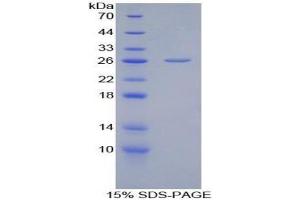 SDS-PAGE analysis of Chicken Adiponectin Protein.