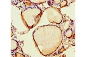 Immunohistochemistry of paraffin-embedded human thyroid tissue using ABIN7167828 at dilution of 1:100 (SCPEP1 anticorps  (AA 201-452))