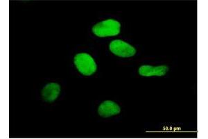 Immunofluorescence of purified MaxPab antibody to RCC1 on HeLa cell.