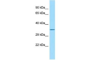 Host: Rabbit Target Name: FAM49B Sample Type: HT1080 Whole Cell lysates Antibody Dilution: 1. (FAM49B anticorps  (C-Term))