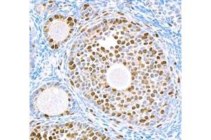 Immunohistochemistry of paraffin embedded mouse ovary using Top2 (ABIN7075937) at dilution of 1:5000 (400x lens)