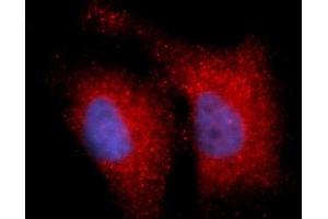 Immunofluorescence (IF) image for anti-Integrin beta 1 (ITGB1) (AA 21-461) antibody (APC) (ABIN5566381) (ITGB1 anticorps  (AA 21-461) (APC))