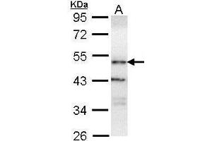 WB Image Sample (30 ug of whole cell lysate) A: H1299 10% SDS PAGE antibody diluted at 1:1000 (OSBPL1A anticorps  (C-Term))