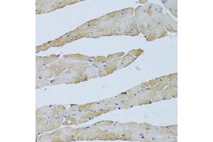 Immunohistochemistry of paraffin-embedded mouse heart using TRAP1 Antibody (ABIN1875197) at dilution of 1:100 (40x lens). (TRAP1 anticorps)