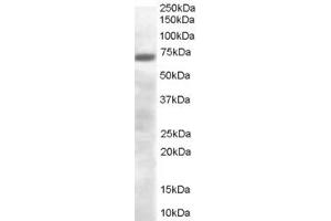ABIN185299 (0. (PRDM4 anticorps  (C-Term))