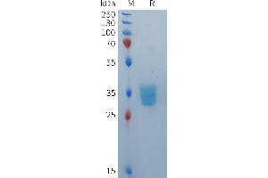 Human BCMA(42-54) Protein, mFc Tag on SDS-PAGE under reducing condition.