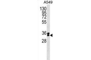 Western Blotting (WB) image for anti-F-Box Protein 44 (FBXO44) antibody (ABIN5019782) (FBXO44 anticorps)