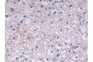 IHC-P analysis of Human Liver Tissue, with DAB staining. (FADS2 anticorps  (AA 1-130))