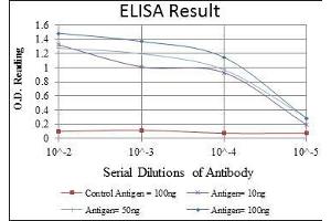 anti-LIM Homeobox 2 (LHX2) antibody