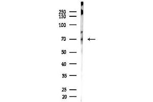 Western blot analysis of lysates from EC304 cells, using NF-kB p65 Antibody at 1/1000 dilution.