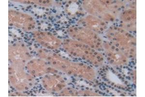 Detection of CXCL7 in Human Kidney Tissue using Polyclonal Antibody to Chemokine (C-X-C motif) ligand 7 ( CXCL7) (CXCL7 anticorps  (AA 59-128))