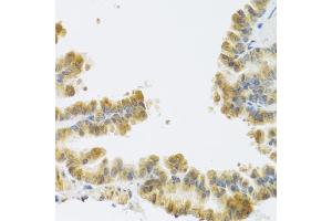 Immunohistochemistry of paraffin-embedded mouse lung using NMU antibody (ABIN6290689) at dilution of 1:100 (40x lens). (Neuromedin U anticorps)