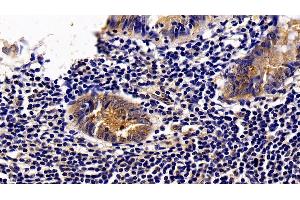 Detection of IL2Ra in Human Appendix Tissue using Polyclonal Antibody to Interleukin 2 Receptor Alpha (IL2Ra)