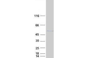 Validation with Western Blot