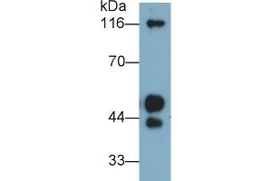 Detection of KNG1 in Human Plasma using Polyclonal Antibody to Kininogen 1 (KNG1) (KNG1 anticorps  (AA 390-644))