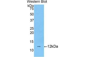 Detection of Recombinant DBI, Mouse using Polyclonal Antibody to Diazepam Binding Inhibitor (DBI)