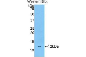 Detection of Recombinant DBI, Mouse using Polyclonal Antibody to Diazepam Binding Inhibitor (DBI) (Diazepam Binding Inhibitor anticorps  (AA 2-87))